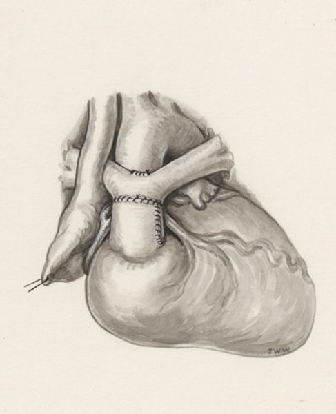 J Wetselaar-Whittaker, Cardiovascular system