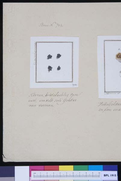M Houtman, Gallstones
