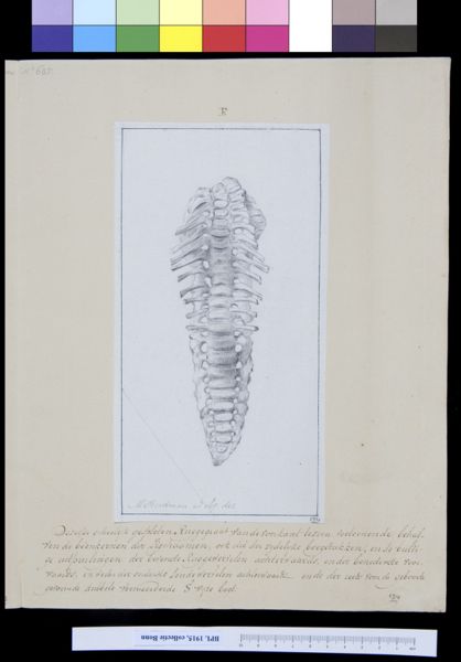 M Houtman, Vertebrae of child with hydrocephalus
