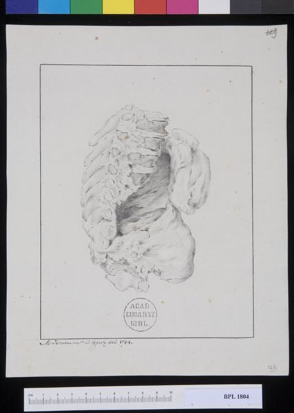 M Houtman, Pathology, fractures (Spine)