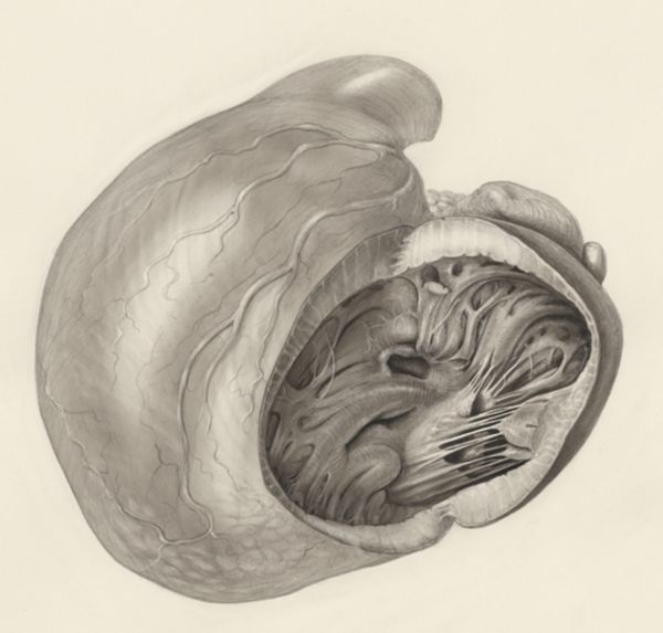 H.G Wetselaar, Heart