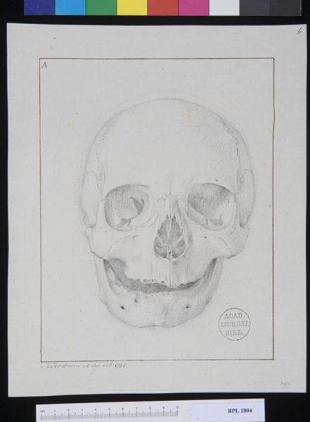 M Houtman, Pathology, fractures
