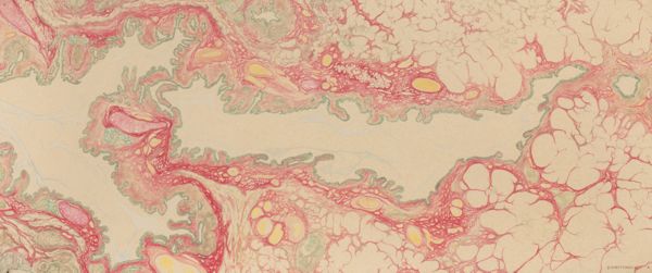 J Wetselaar-Whittaker, Lung tissue