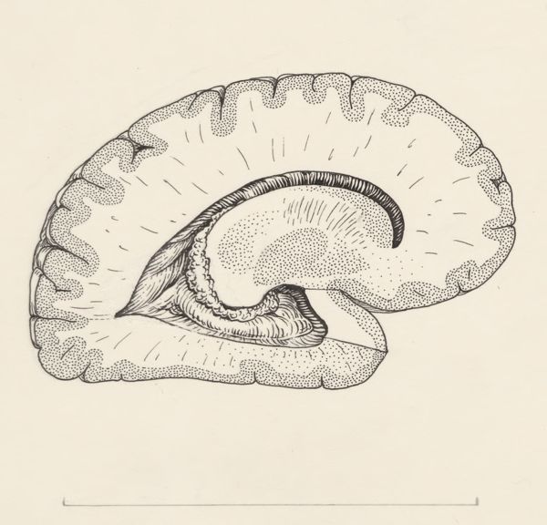 J Tinkelenberg, Cross section of the human brain