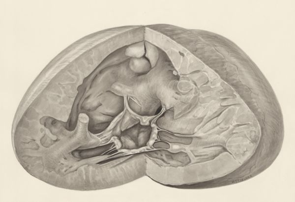 H.G Wetselaar, Heart