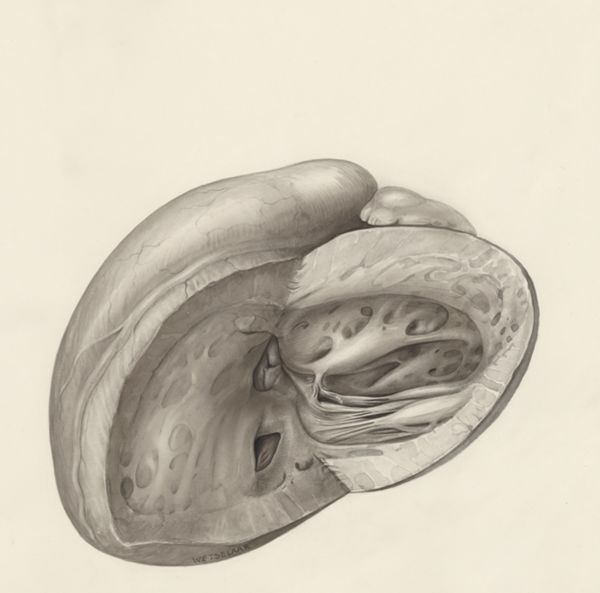 H.G Wetselaar, Heart