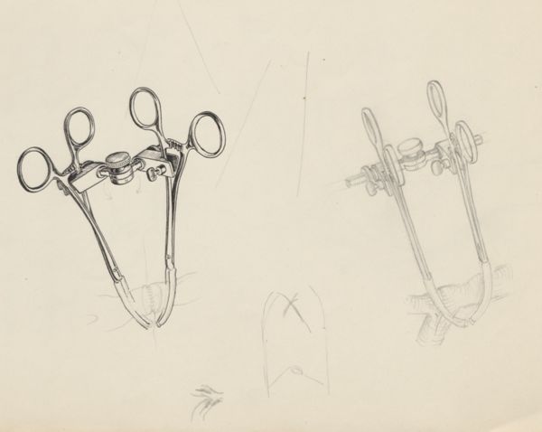 J Tinkelenberg, Surgical clamps holding a vein (verso: Sketch of the circulatory system)