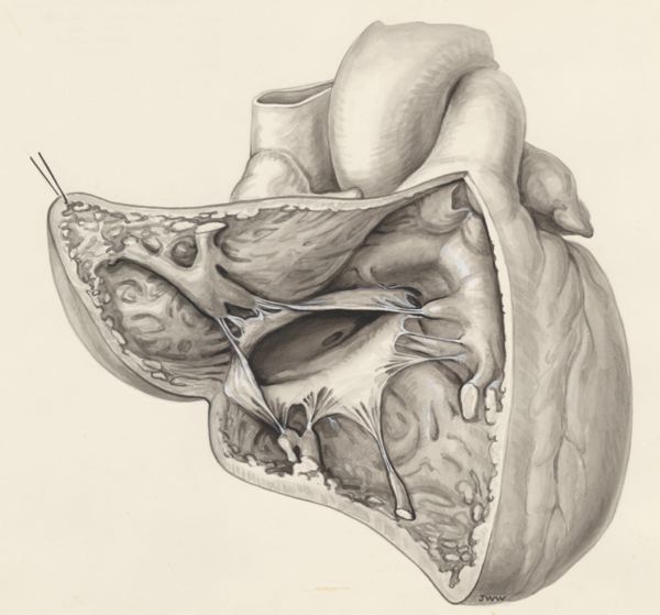 J Wetselaar-Whittaker, Heart