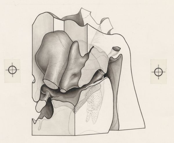 J Tinkelenberg, Part of the heart and circulatory system