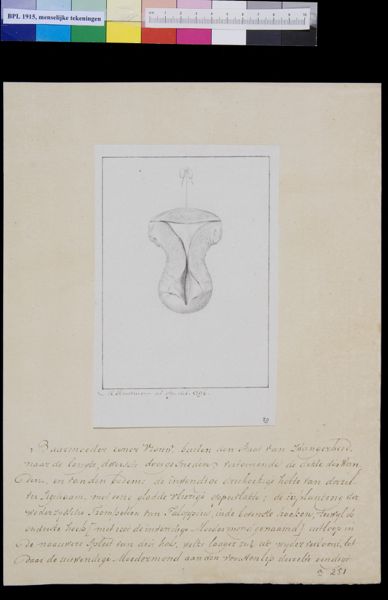 M Houtman, Foetus