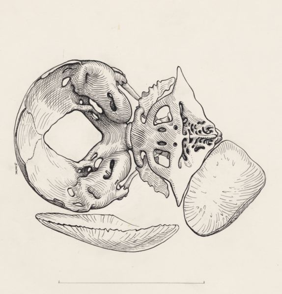 J Wetselaar-Whittaker, Human tissue