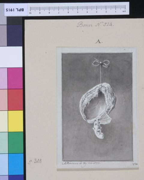M Houtman, Fetus with cleft lip
