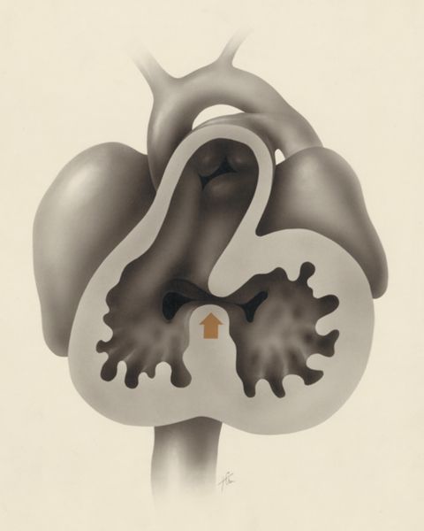 J Tinkelenberg, Embryonic heart