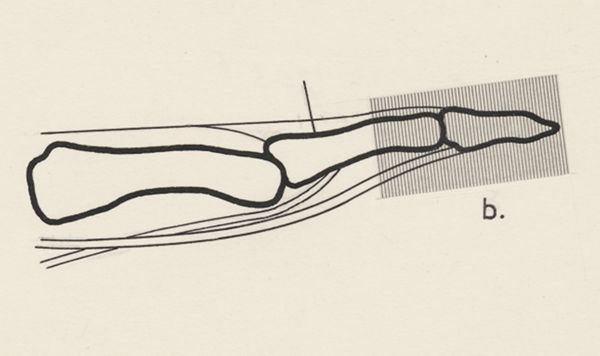 Harry de Bles, Schematic representation of the finger