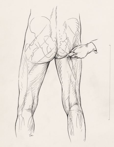 J Tinkelenberg, Human buttocks and pelvic bones