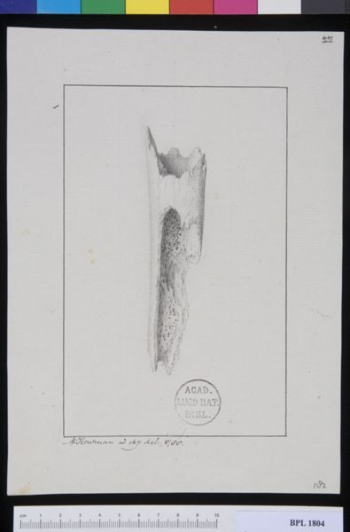 M Houtman, Pathology, fractures (Lower leg)