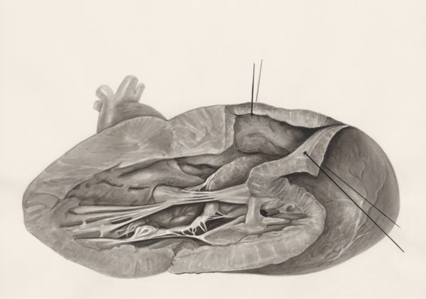 H.G Wetselaar, Heart