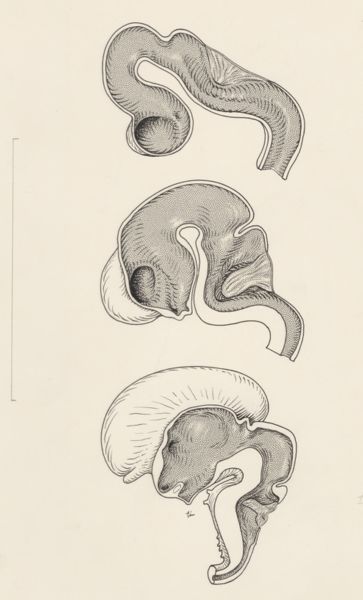 J Tinkelenberg, Three cross sections of human tissue