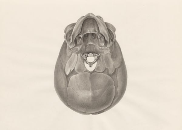 H.G Wetselaar, Deformed fetal skull, seen from below