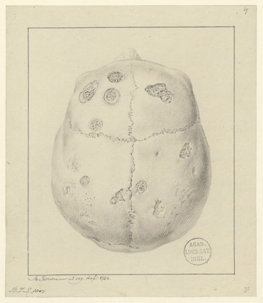 M Houtman, Skull; Pathology, fractures